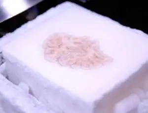 Slicing memory: Each of H.M.’s 2401 brain slices is a window into the architecture of thought.