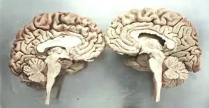 Slicing memory: Each of H.M.’s 2401 brain slices is a window into the architecture of thought.